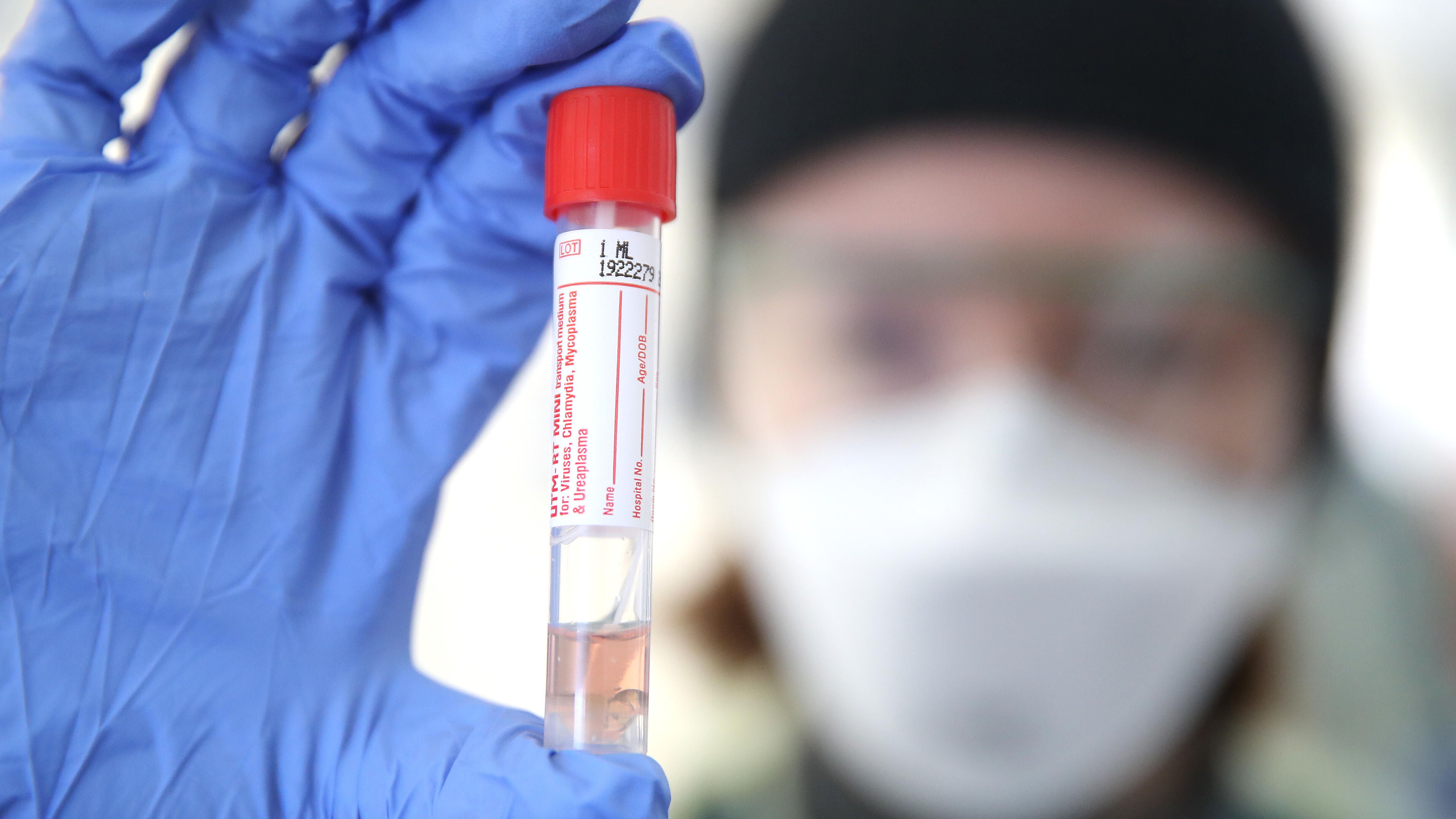 Coronavirus Antibody Nasal Swab Saliva Testing What To Know About Covid 19 Tests Cnet